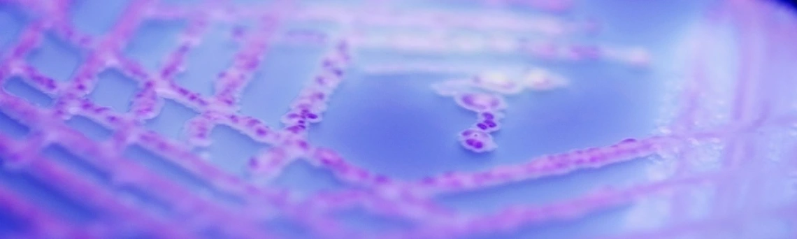 petri dish